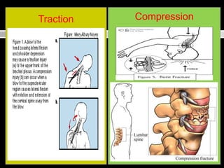 Compression Traction Signe SPORT INJURI ( Dr Sonny Gosal M KES AIFO).ppt