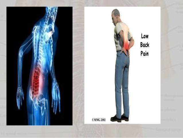 Sport Injuries - Back injury