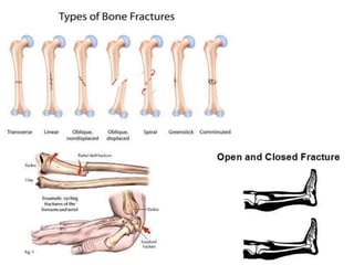 Sport – related injuries