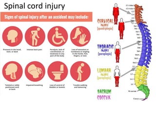 Spinal cord injury
 