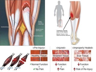 Sport – related injuries