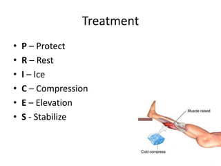 Treatment
• P – Protect
• R – Rest
• I – Ice
• C – Compression
• E – Elevation
• S - Stabilize
 
