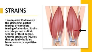 Strains Sports Injuries Sports-Related-Injuries-.pptxfrommapehgrade10 | PPTX