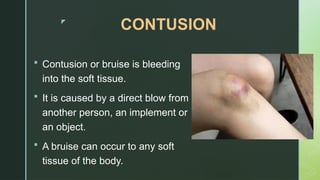 Sports-Related Injury lesson 3-4 q2.pptx