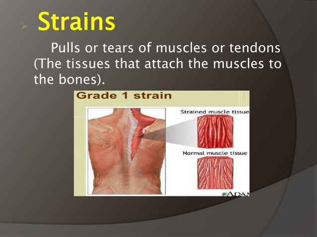 Sports Injuries PPT