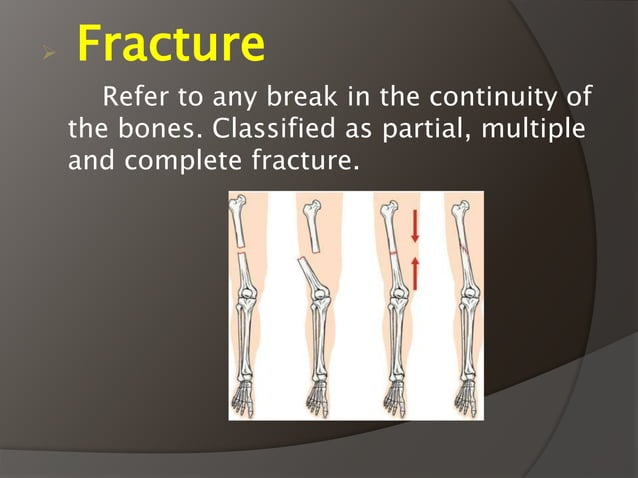 Sports Injuries PPT