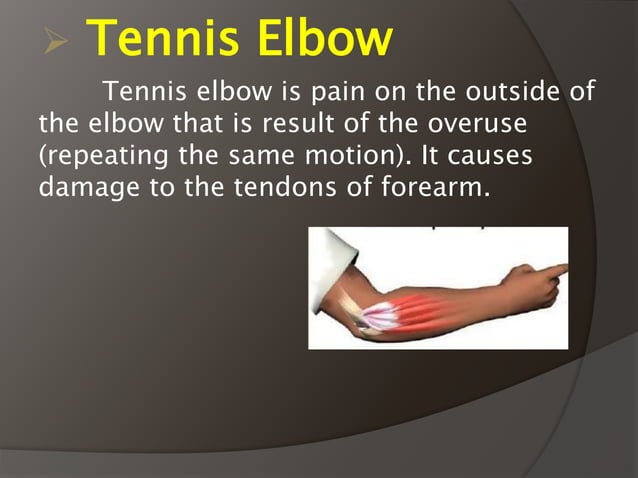 Sports Injuries PPT