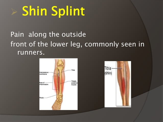 Sports Injuries PPT