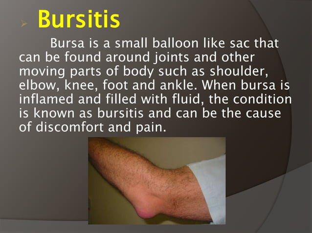 Sports Injuries PPT