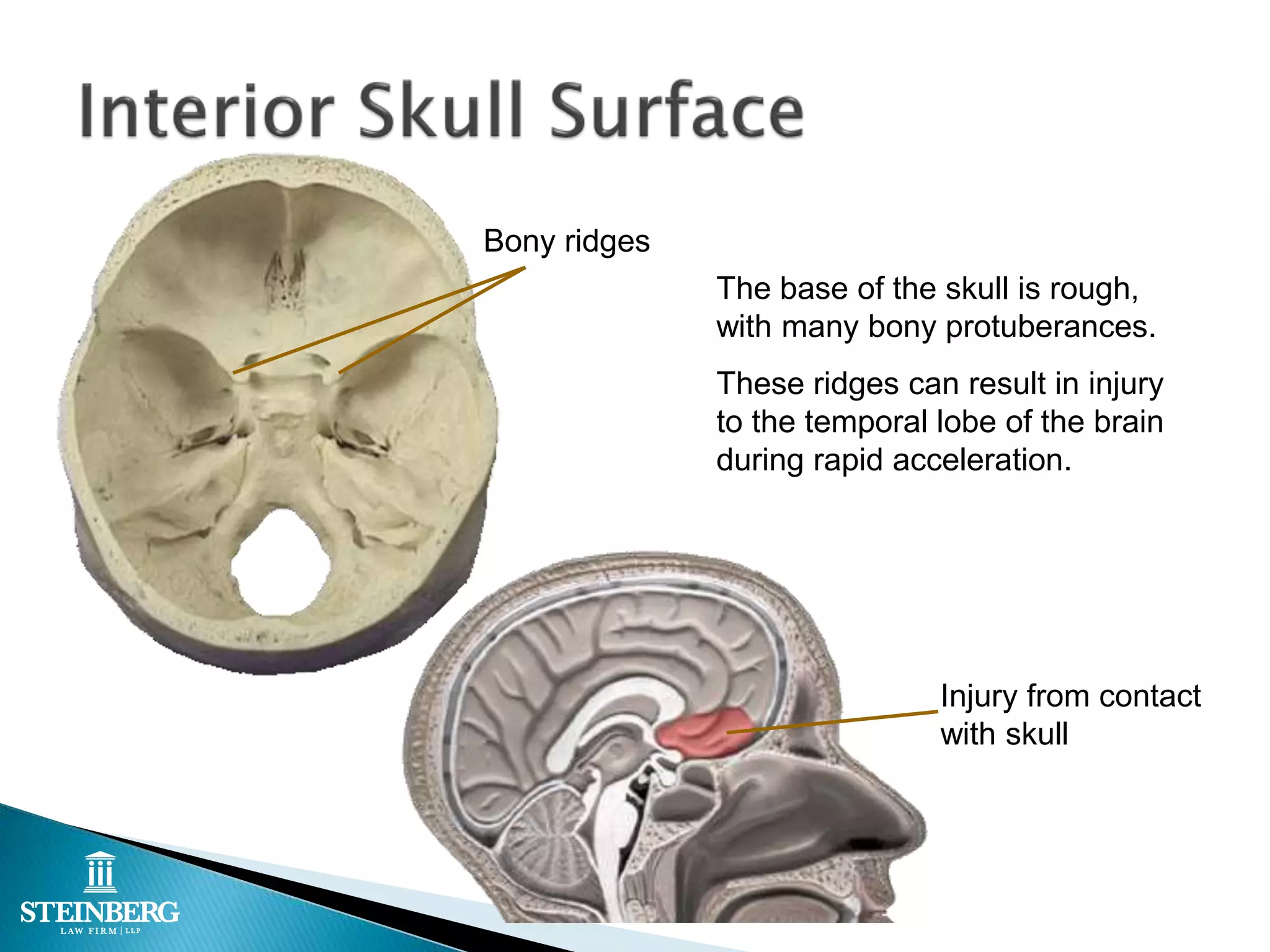 Sports injuries and the law | PPTX
