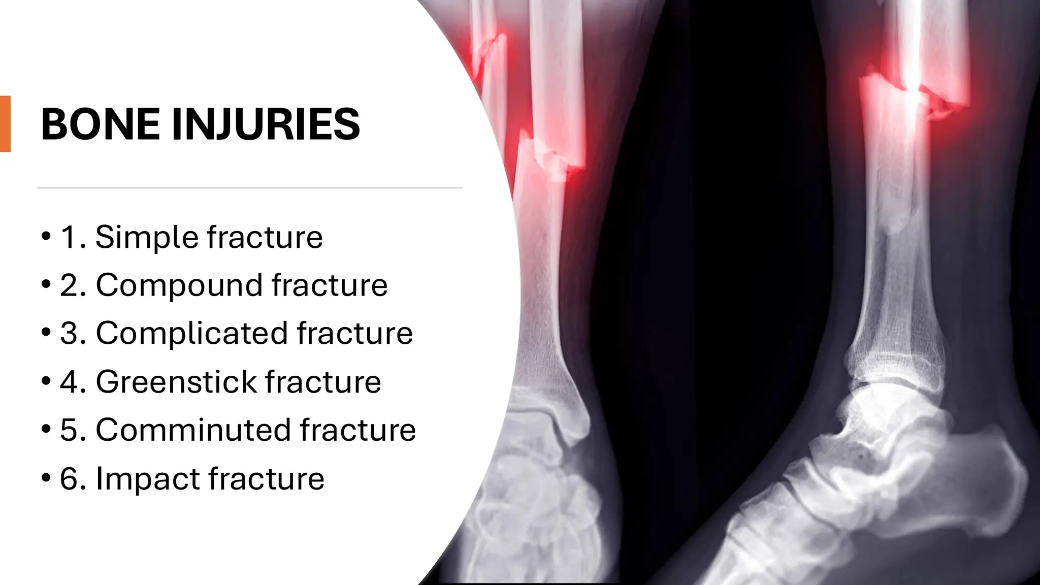 sports injuries class 12 physical education cbse.pdf