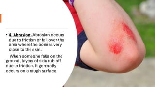 sports injuries class 12 physical education cbse.pdf