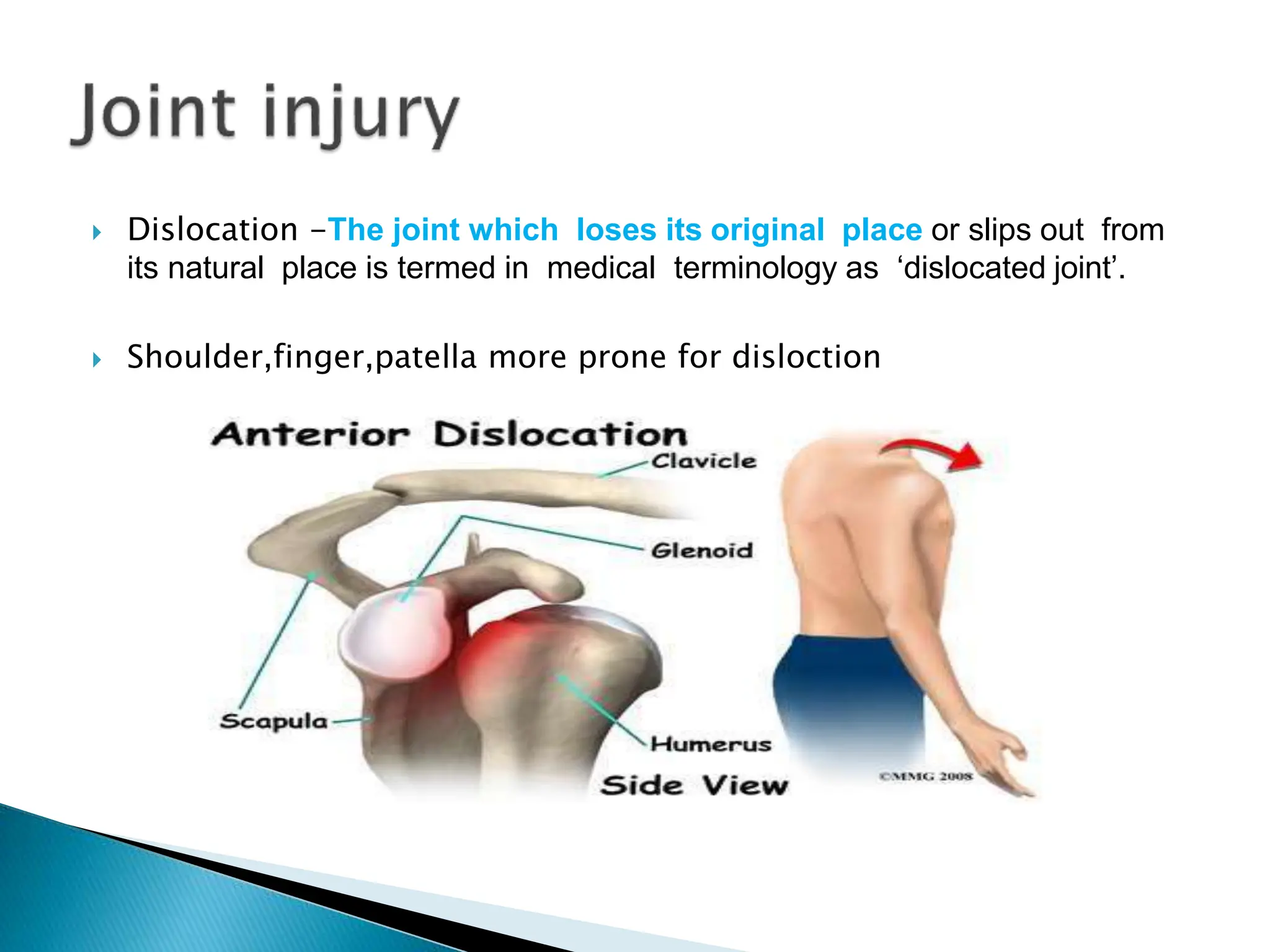 Sports Injuries(Classification).pptx