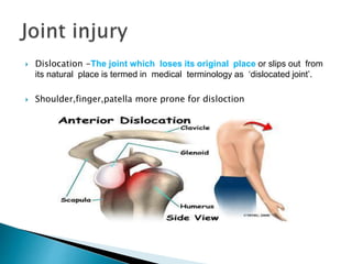Sports Injuries(Classification).pptx
