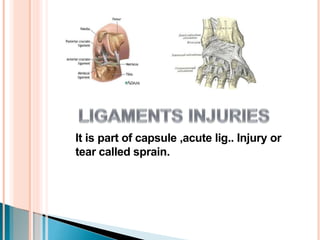 Sports Injuries(Classification).pptx