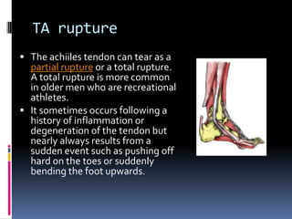 Sports injury | PPTX
