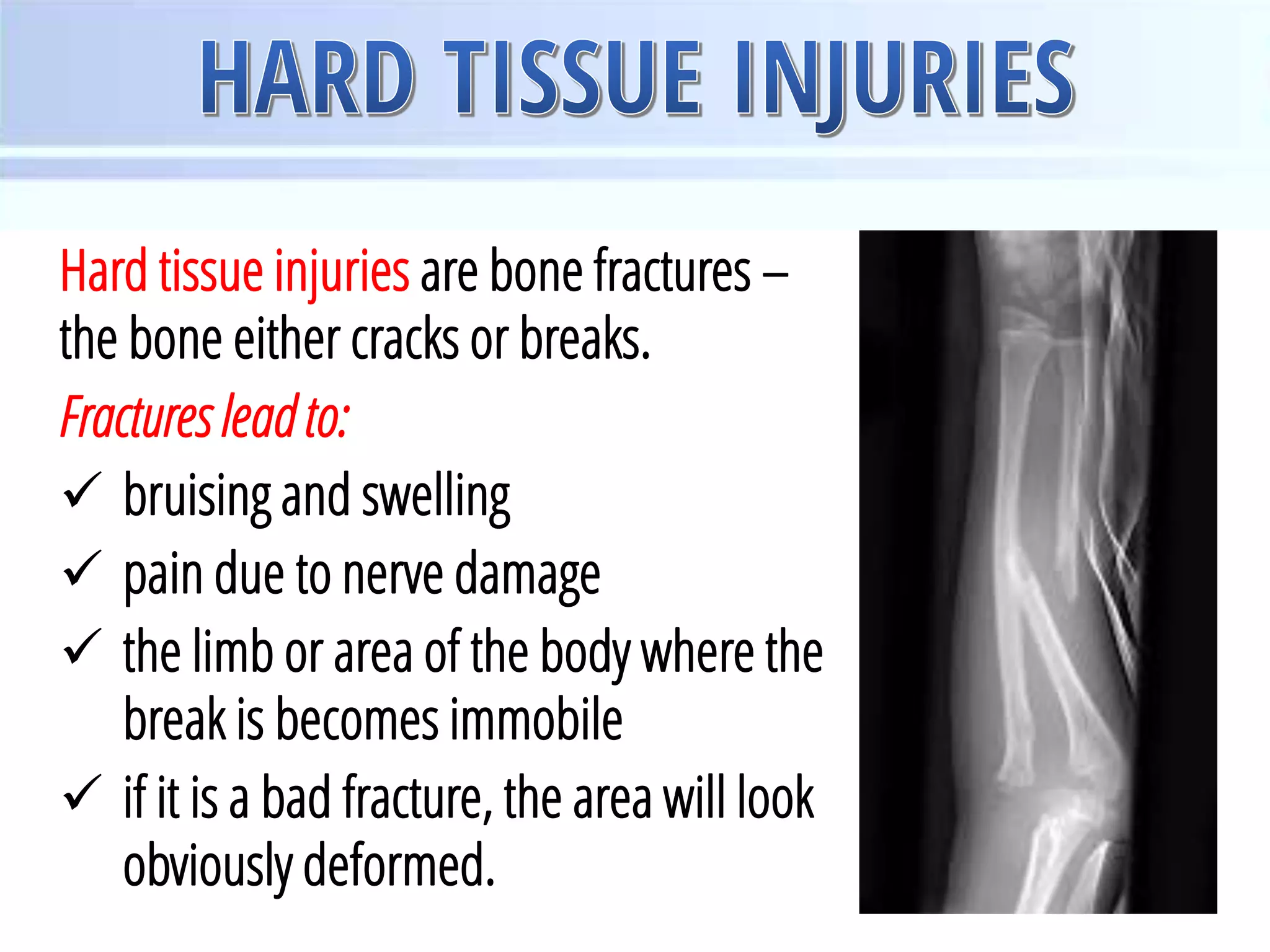 Sports Injury | PDF