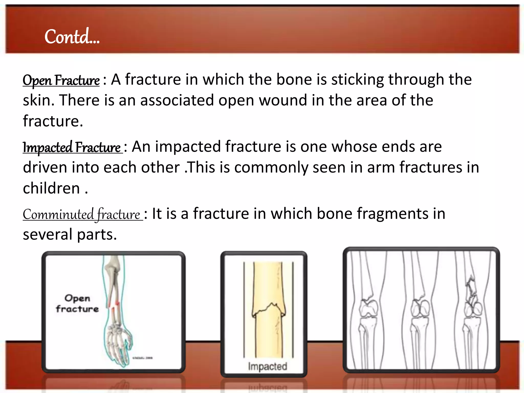 Simple Open Injuries Sports Injury in Detail | PPTX