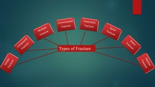 Types of Fracture
 