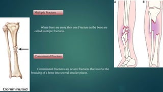 Multiple Fracture
When there are more then one Fracture in the bone are
called multiple fractures.
Comminuted Fracture
Comminuted fractures are severe fractures that involve the
breaking of a bone into several smaller pieces.
 