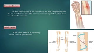 Greenstick Fracture
the bone partly fractures on one side, but does not break completely because
the rest of the bone can bend. This is more common among children, whose bones
are softer and more elastic
Spiral Fracture
When a bone is broken by the twisting
force is known as spiral fracture.
 