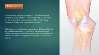Dislocation
A dislocation is an injury to a joint — a place where two or
more bones come together — in which the ends of your bones
are forced from their normal positions. This painful injury
temporarily deforms and immobilizes your joint.
Dislocation is a condition that happens when the bones of a joint
are knocked out of place. A joint can be partially dislocated
(subluxation) or fully dislocated. A dislocation can be caused by
a trauma (Collation or fall) or the weakening of muscles and
tendons.
 