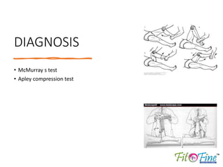 DIAGNOSIS:
• Strength testing: pain will be
illiciated with resisted plantar
flexion against resistance.
• MRI
• X-RAY
• U...