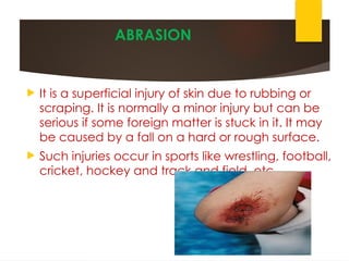 SPORTS INJURY by Diwakar Kashyap Sir | PPTX