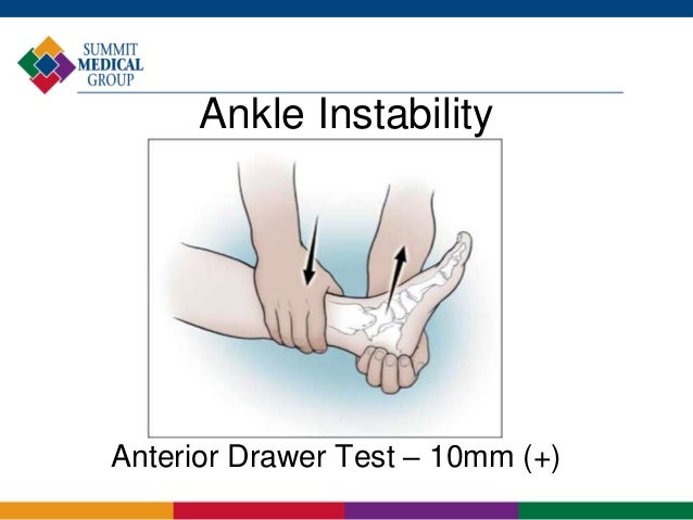 Ankle And Foot Injuries For Athletes Dr Andre Ross Livingston Li