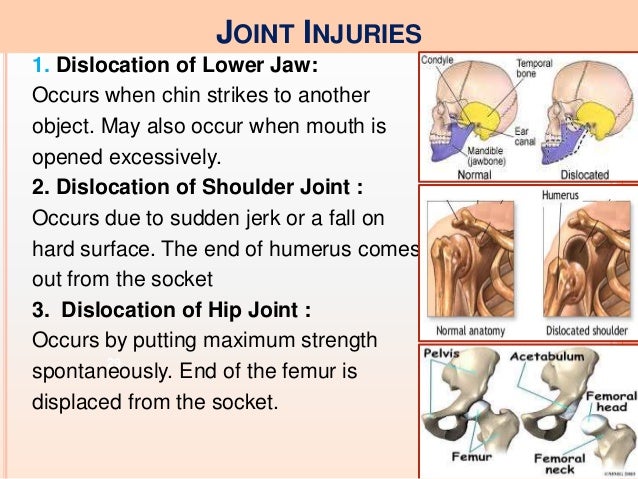 preferential treatment for athletes preferential treatment for athletes