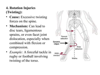Sci Excessive Rotation Sports Medicine MPEd Notes by Diwakar Sir.pptx