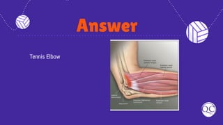 Answer
Tennis Elbow
 