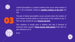 03
Lateral Epicondylitis is a painful condition that occurs when tendons in
your Y are overloaded, usually by repetitive motions of the wrist and
arm.
The pain of lateral epicondylitis occurs primarily where the tendons of
your forearm muscles attach to a bony bump on the outside of your Y.
Pain can also spread into your forearm and wrist.
This condition is mostly seen in athletes who play X because of
excessive strain caused in these muscles while playing.That’s why it is
also referred to as XY.
ID XY.
 
