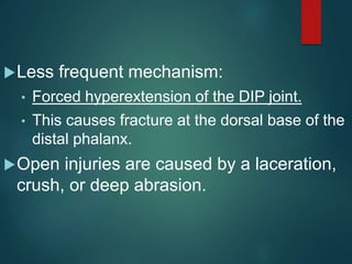 Open Deep Injuries Sports related injuries to hand sagar | PPTX