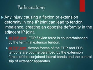 Fds Injuries Sports related injuries to hand sagar | PPTX