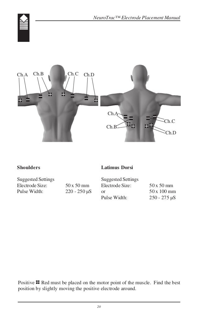 NeuroTrac Sports XL electrode placement manual (English)