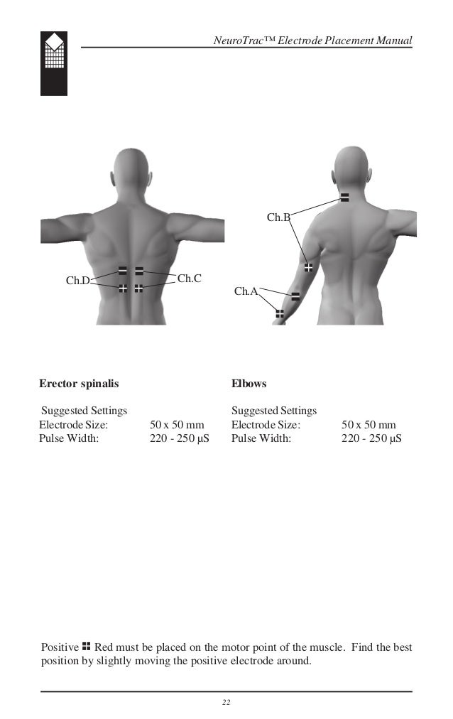 NeuroTrac Sports XL electrode placement manual (English)