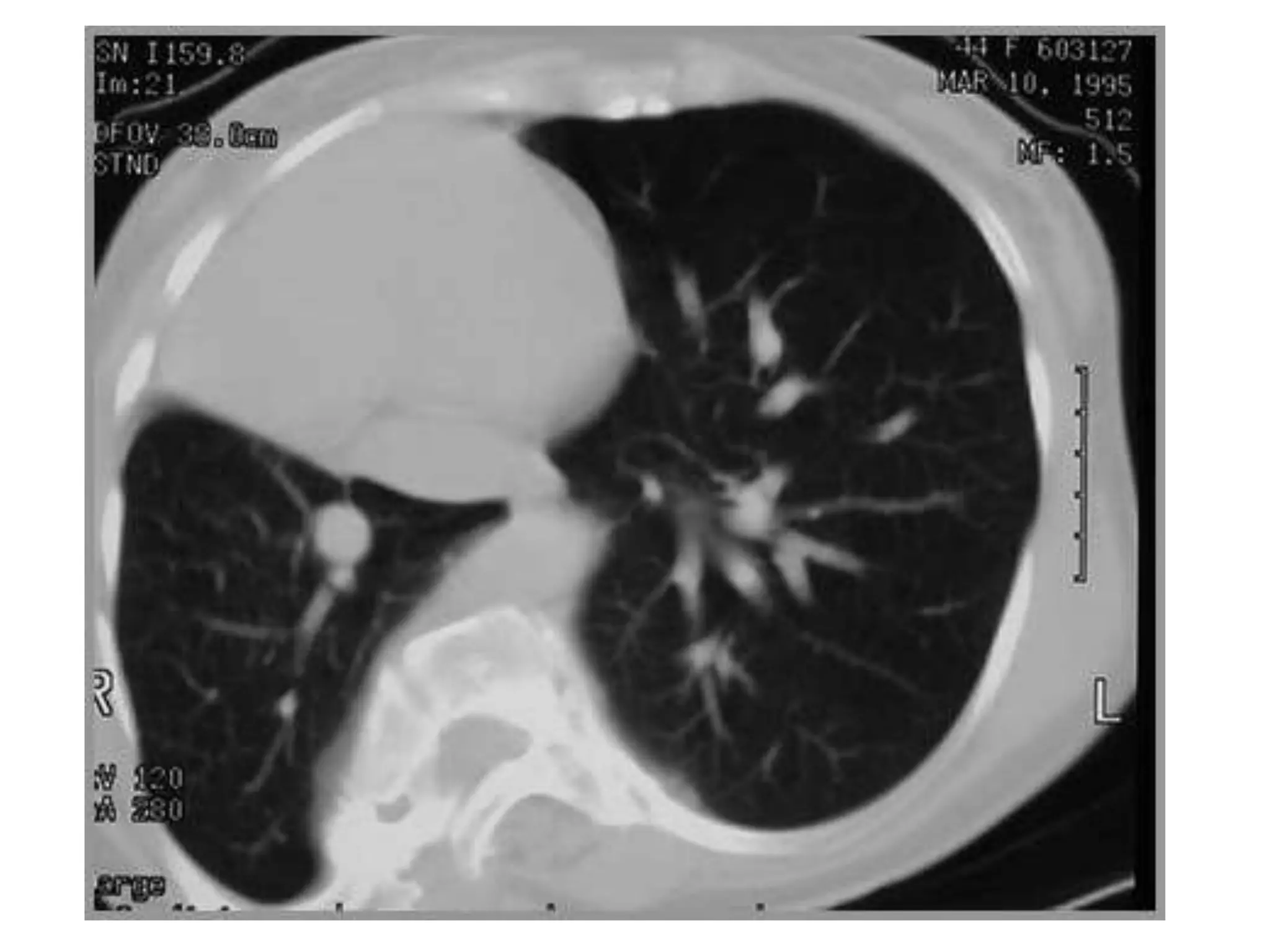 Spot diagnosis for radiology second master degree | PPTX