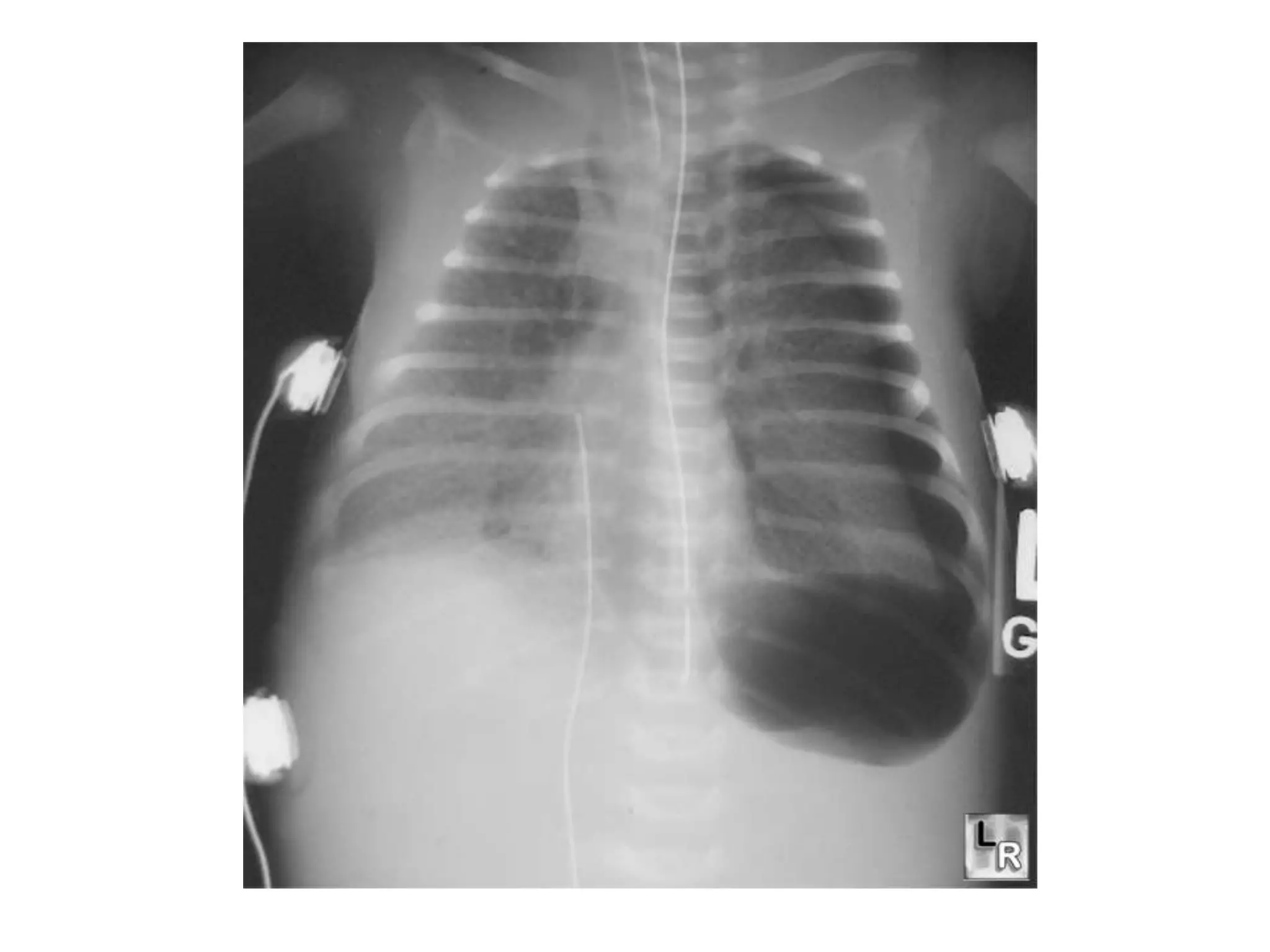Spot diagnosis for radiology second master degree | PPTX