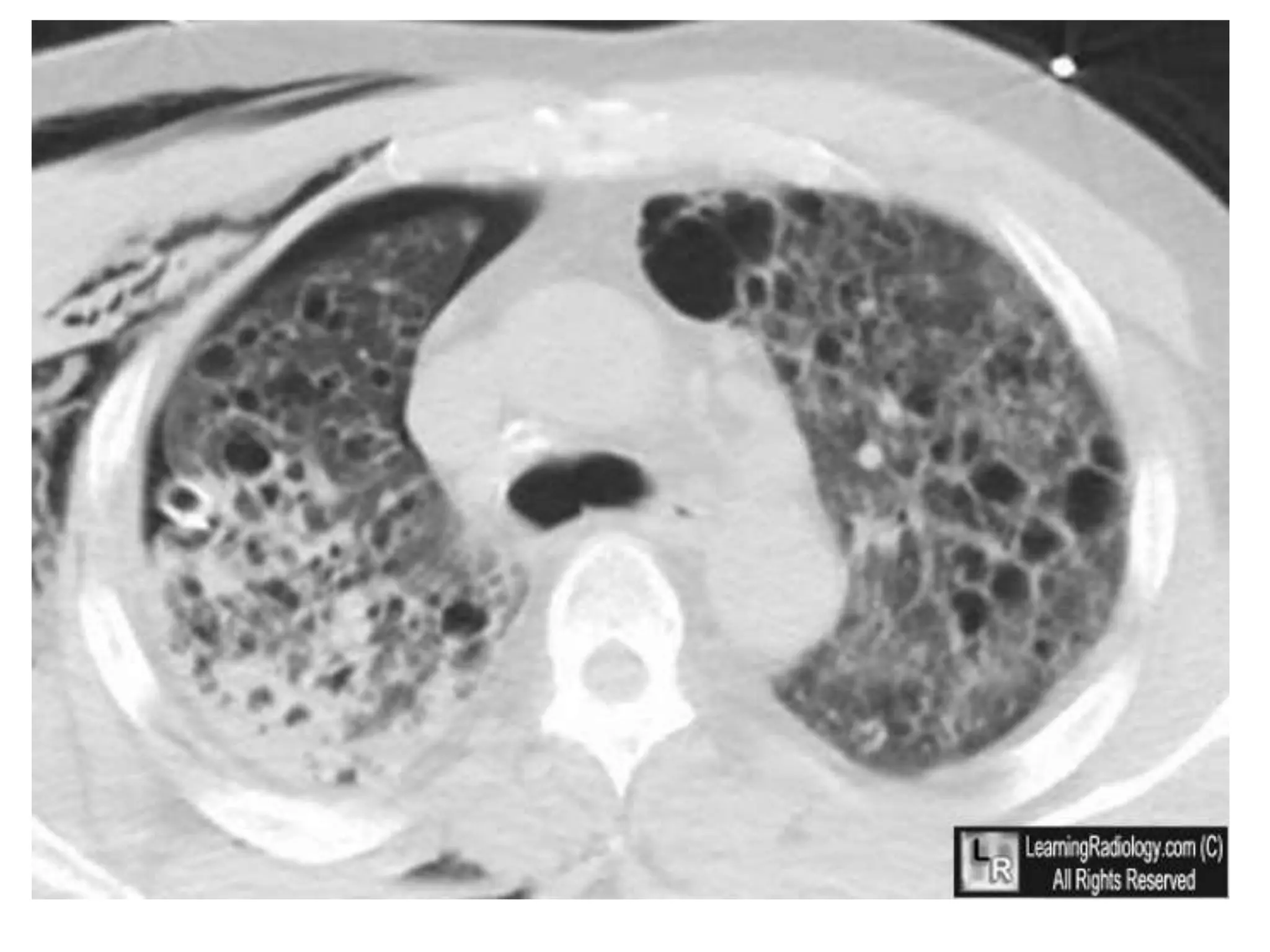 Spot diagnosis for radiology second master degree | PPTX