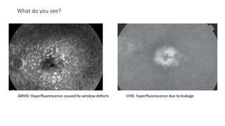 Spot Diagnosis - Look at the pictures-What do you See - Acquired ...