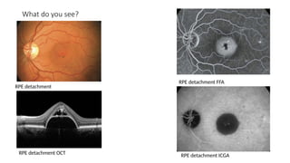 Spot Diagnosis - Look at the pictures-What do you See - Acquired ...