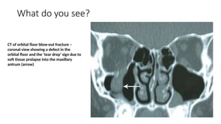 Spot Diagnosis - Look at the pictures-What do you See - Trauma.pptx