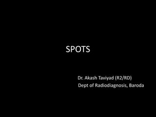 SPOTS
Dr. Akash Taviyad (R2/RD)
Dept of Radiodiagnosis, Baroda
 