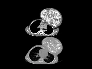 SPOTS of radiology for exam going students | PPTX