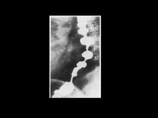 SPOTS of radiology for exam going students | PPTX