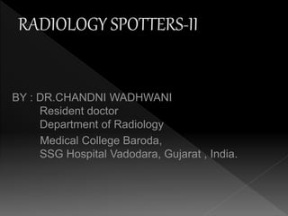 BY : DR.CHANDNI WADHWANI
Resident doctor
Department of Radiology
Medical College Baroda,
SSG Hospital Vadodara, Gujarat , India.
 