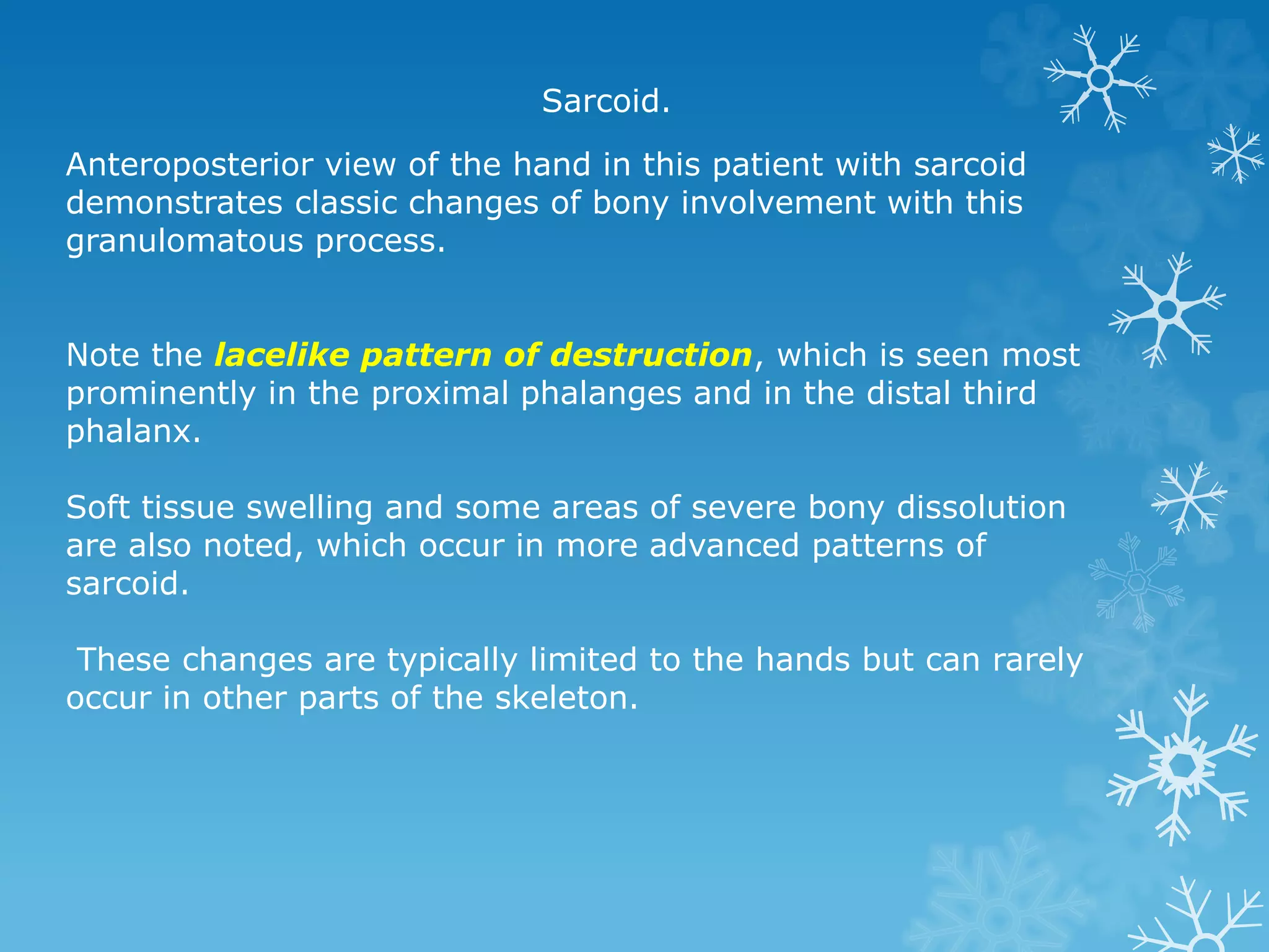 Anteroposterior view of the hand in this patient with sarcoid
demonstrates classic changes of bony involvement with this
granulomatous process.
Note the lacelike pattern of destruction, which is seen most
prominently in the proximal phalanges and in the distal third
phalanx.
Soft tissue swelling and some areas of severe bony dissolution
are also noted, which occur in more advanced patterns of
sarcoid.
These changes are typically limited to the hands but can rarely
occur in other parts of the skeleton.
Sarcoid.
 