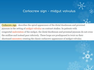 Corkscrew sign - midgut volvulus
 