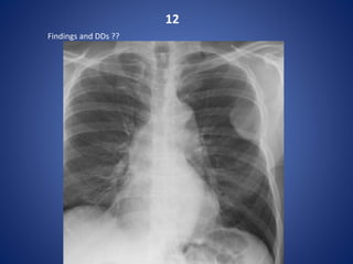 12
Findings and DDs ??
 